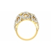 Rings  DDS RN 232-F